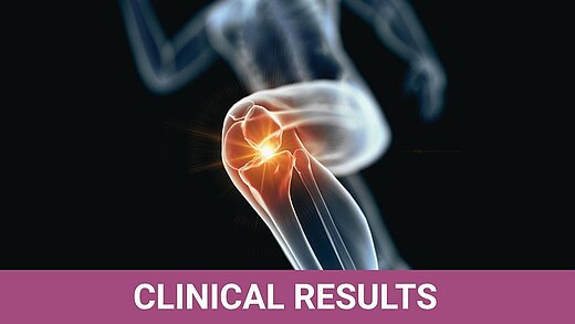 3D medical illustration of a human knee joint with highlighted inflammation, labeled "Clinical Results"